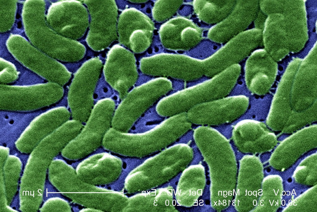 Vibrio vulnificus reference to the appearance of the virus through a microscope