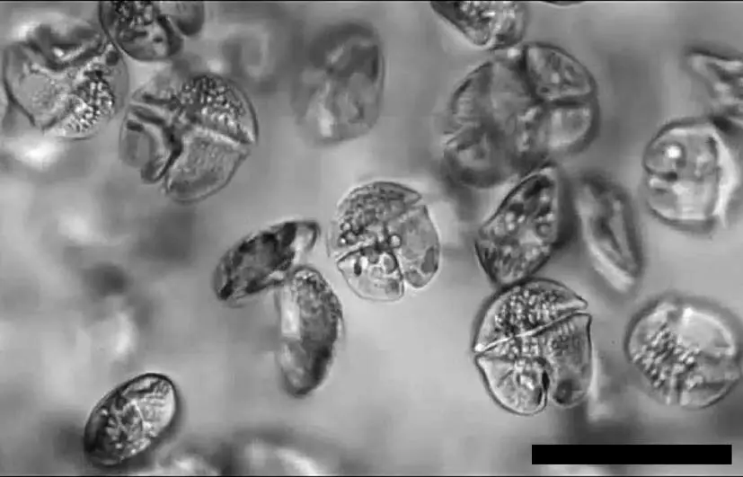 First record of red tide due to the harmful dinoflagellate Karenia mikimotoi in Hakodate Bay, southern Hokkaido, in autumn 2015 - Scientific Figure on ResearchGate. Available from: https://www.researchgate.net/figure/Microphotograph-showing-the-swimming-cells-of-Karenia-mikimotoi-collected-at-Moheji_fig1_308573929 [accessed 26 May 2025]